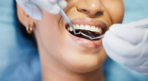 Best Emergency Dental Extractions in Liolnton, NC
